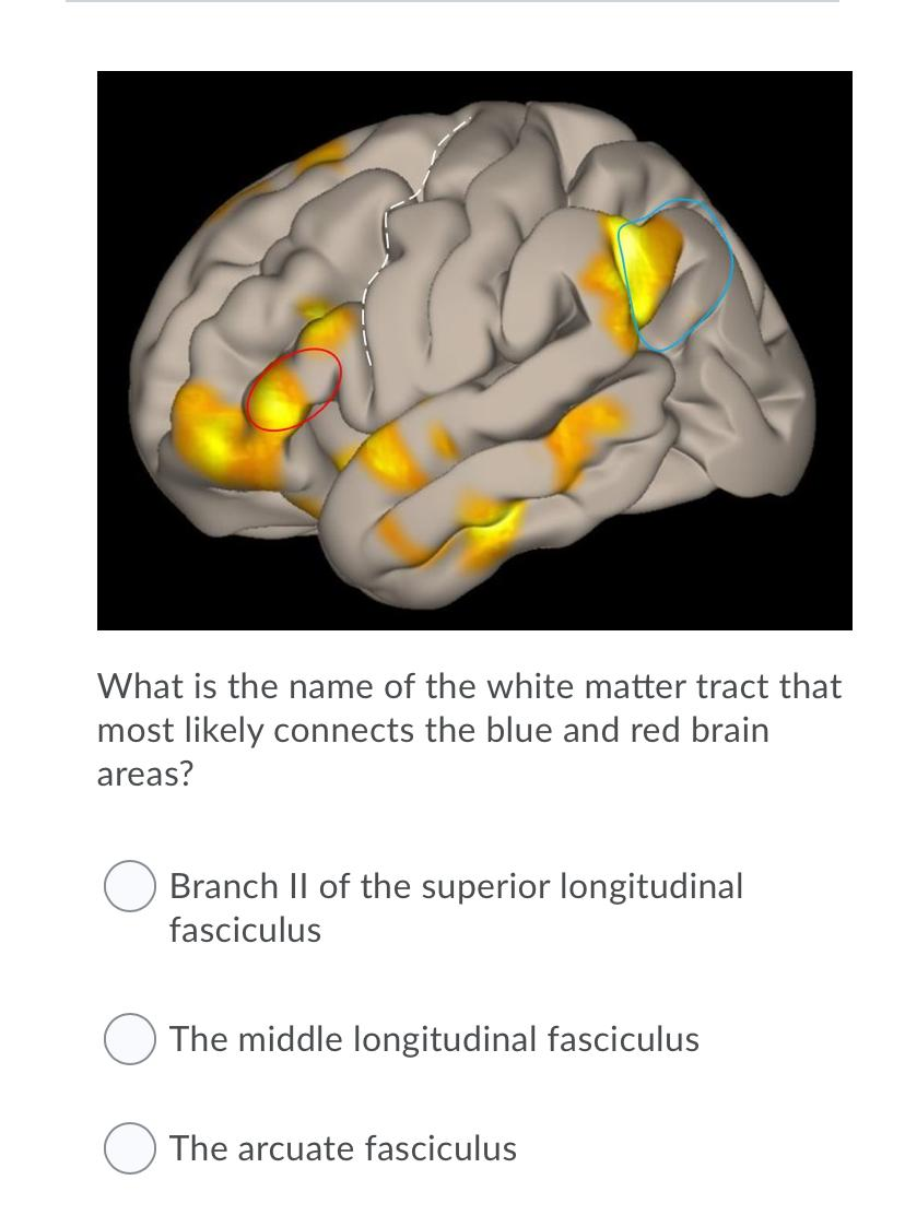 Solved What is the name of the white matter tract that most | Chegg.com