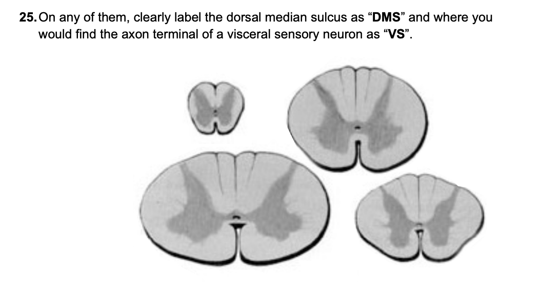 25. On any of them, clearly label the dorsal median sulcus as DMS and where you would find the axon terminal of a visceral 