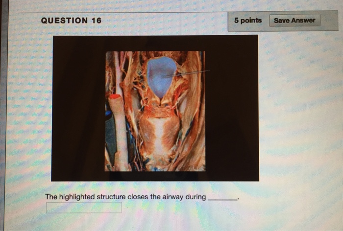 Solved QUESTION 17 5 points Save A Identify the highlighted | Chegg.com