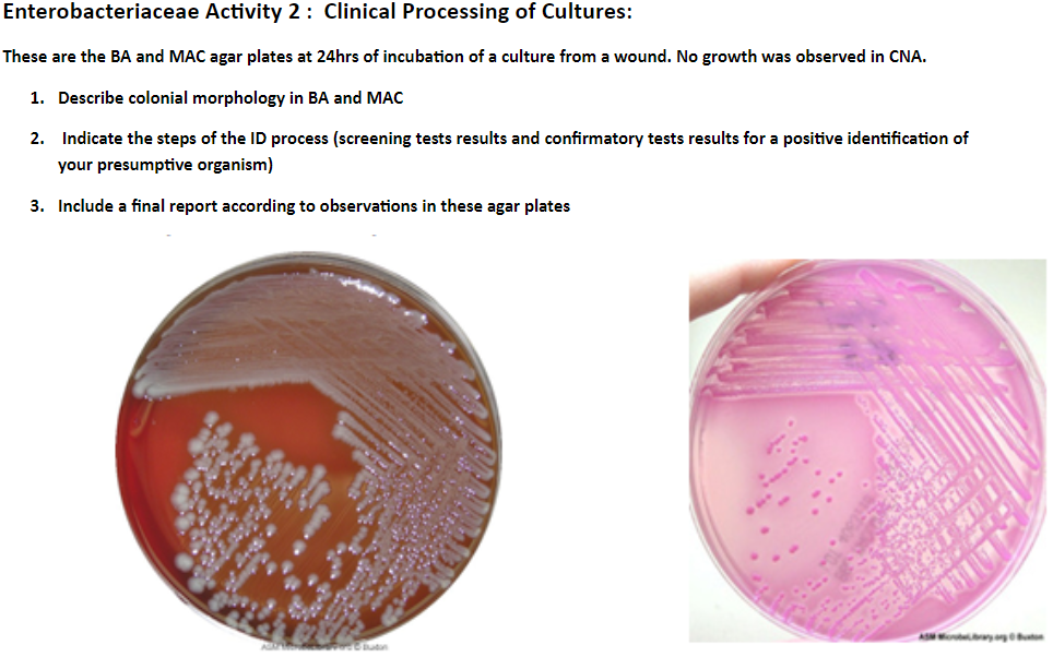 Solved Enterobacteriaceae Activity 2: Clinical Processing of | Chegg.com