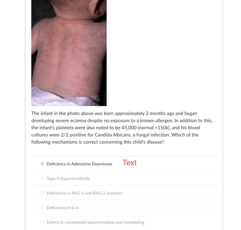 Solved Incorrect Question 1 0/1 pts A 28 year old Caucasian | Chegg.com
