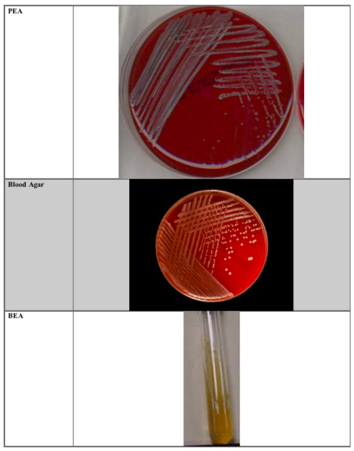 Solved Test Gram Stain Picture of Results TSA Plate SIM | Chegg.com