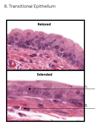 Solved 5. Pseudostratified Columnar Epithelium (Trachea) 1. | Chegg.com