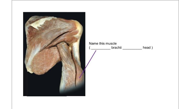 Solved Name this muscle Name this muscle Name this | Chegg.com