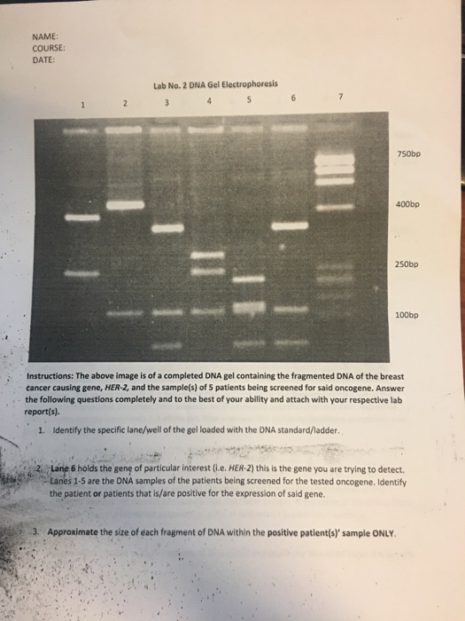 Solved NAME COURSE DATE Lab No. 2 DNA Gel Electrophoresis