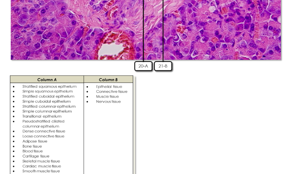 Solved Identify The Tissues 17 18 19 20 5 1999 By The Chegg Com