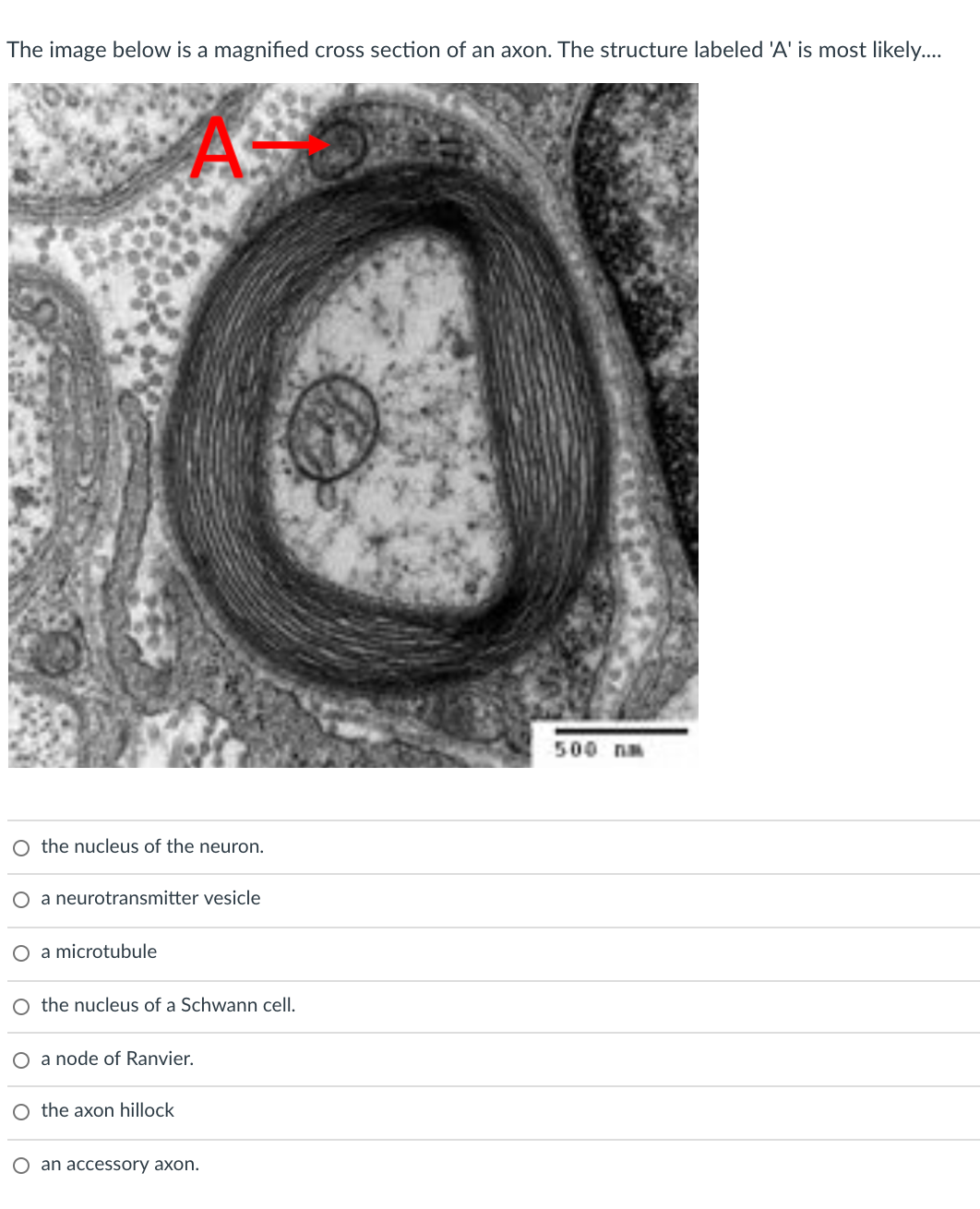 Solved The image below is a magnified cross section of an | Chegg.com