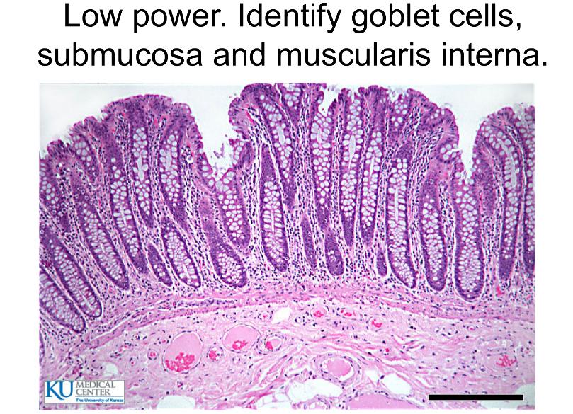 Solved Low power. Identify goblet cells, submucosa and