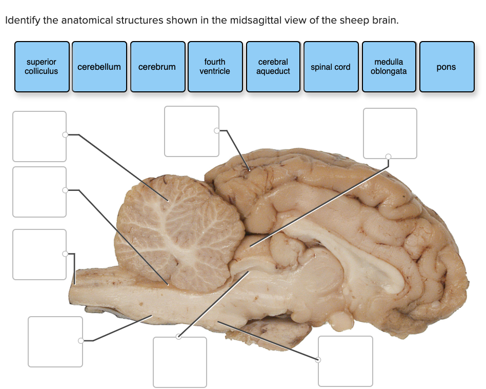 brain midsagittal view