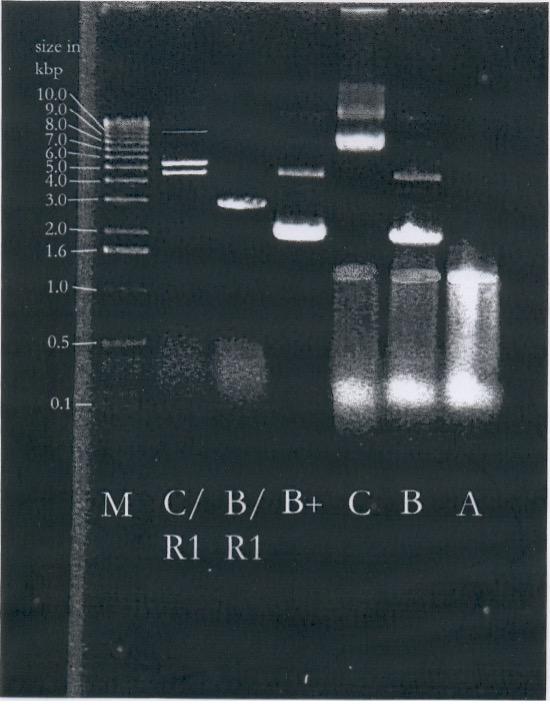 Solved Analysis of plasmid DNA on gel electrophoresis | Chegg.com
