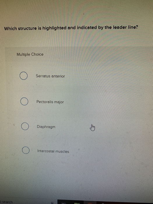 Which Structure Is Highlighted And Indicated By The Leader Line