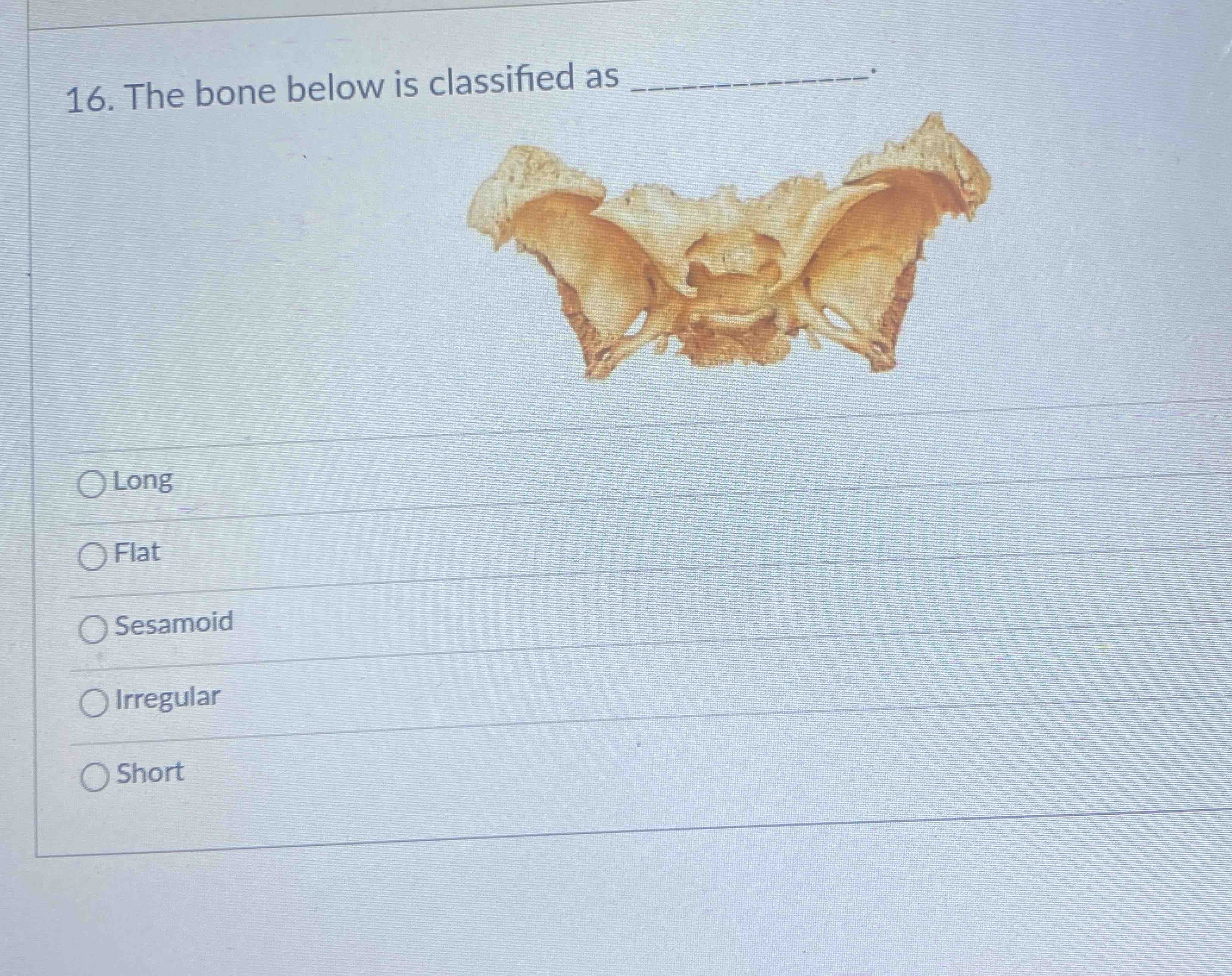 Solved The bone below is classified | Chegg.com