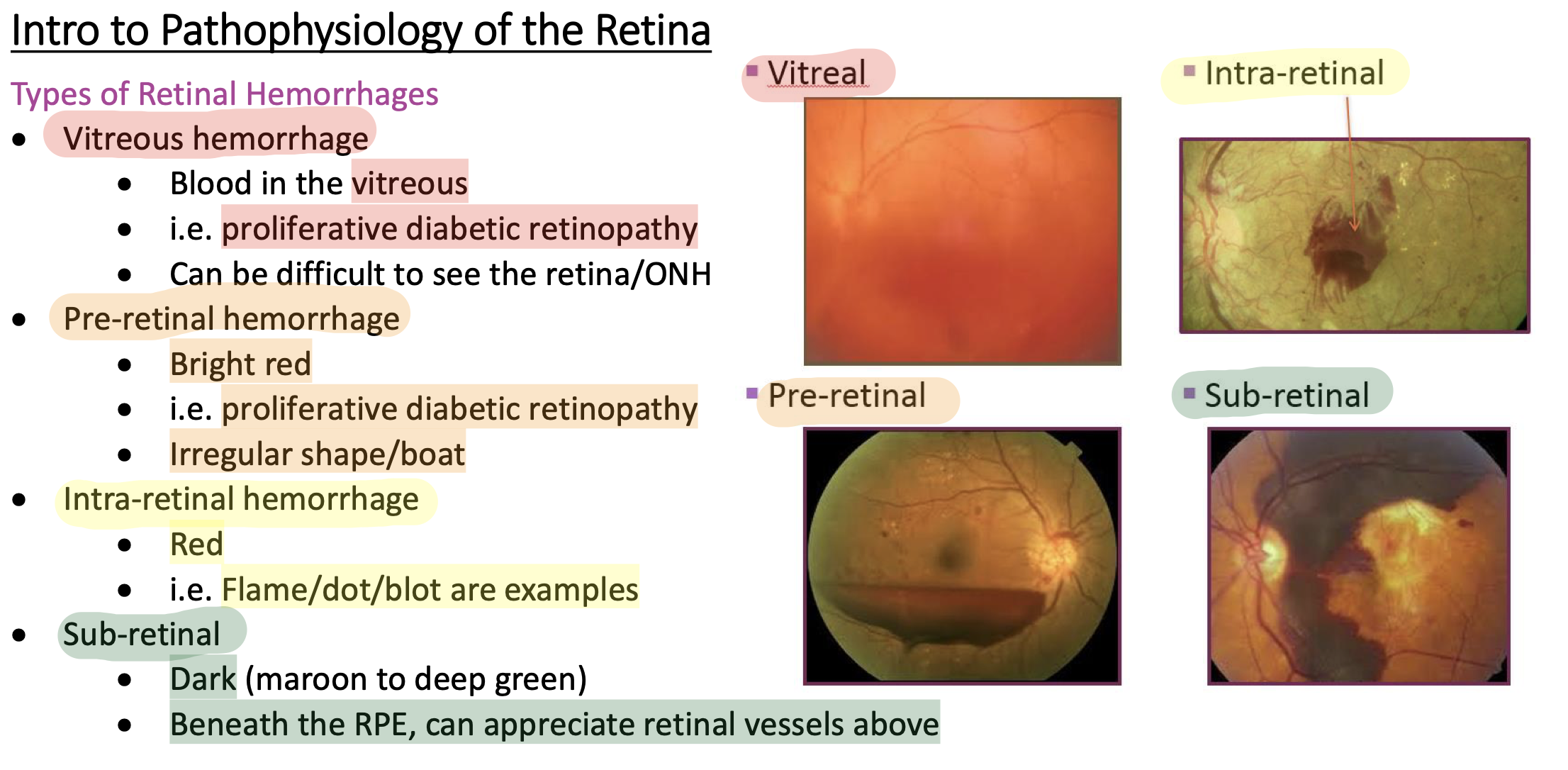 retinal flame hemorrhage