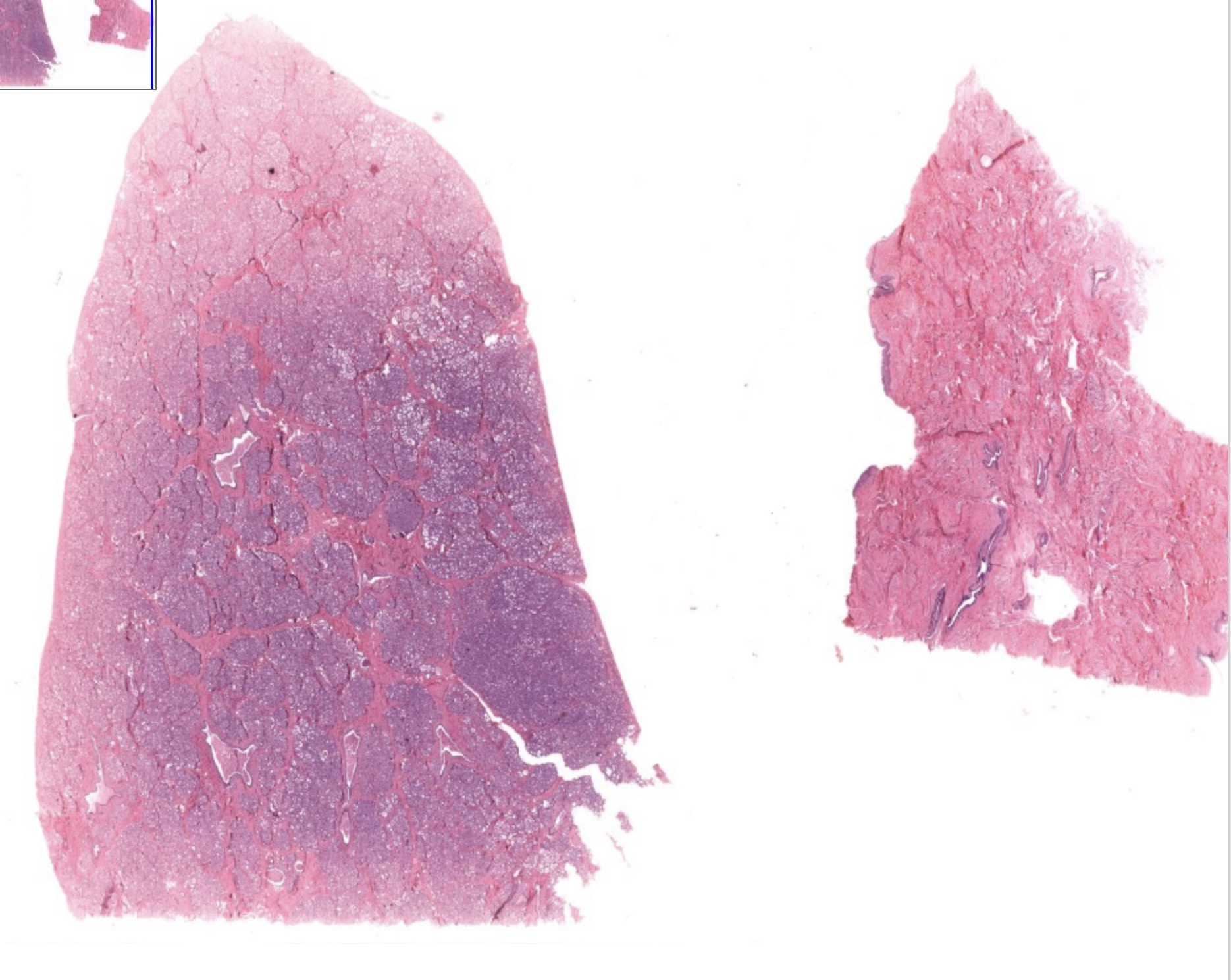 Solved describe at least two differences you see between the | Chegg.com