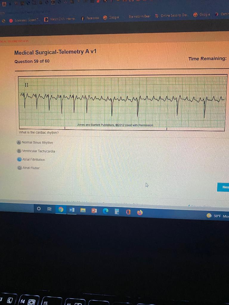 solved-c-medical-surgical-telemetry-a-v1-question-7-of-60-chegg