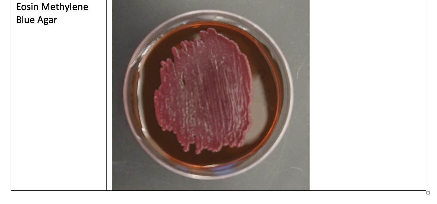 Solved I have to do a lab report about an unknown bacteria.