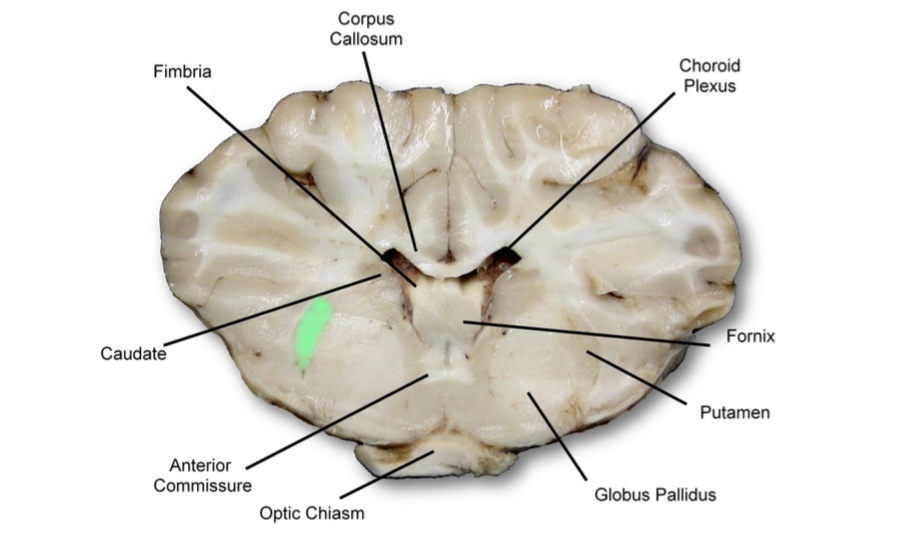 Solved What Is The Area Labeled Green In The Cow Brain 