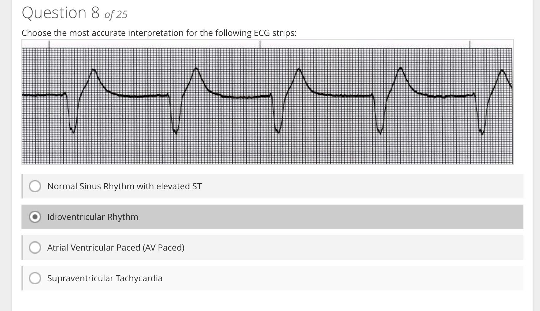 Normal Sinus Rhythm with elevated ST
Idioventricular Rhythm
Atrial Ventricular Paced (AV Paced)
Supraventricular Tachycardia