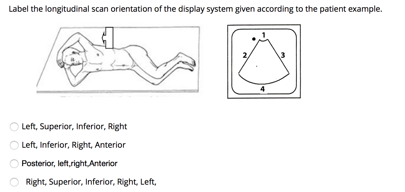Solved Label the longitudinal scan orientation of the