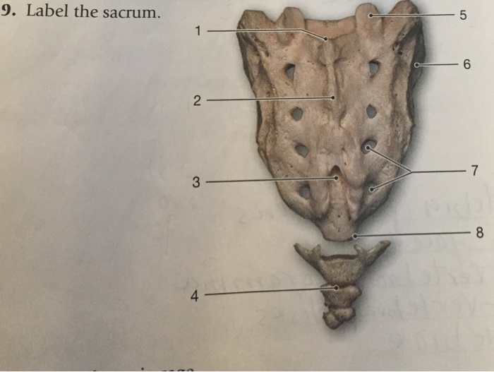 Solved 9. Label the sacrum. 6 2 7 3 4 | Chegg.com