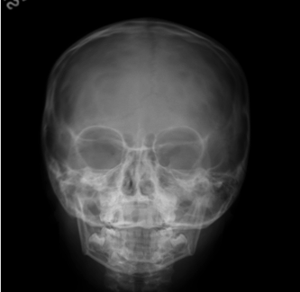 Normal Rad skull Flashcards | Chegg.com