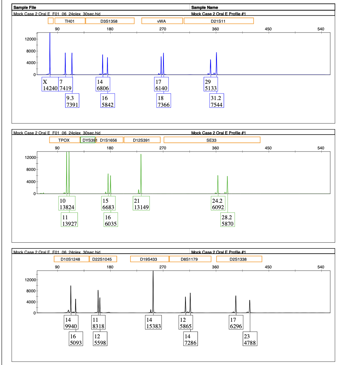 Solved Examine The Amelogenin Locus And Indicate If The Dna Chegg Com