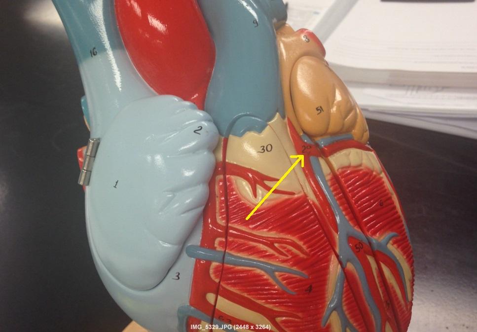 posterior interventricular artery model