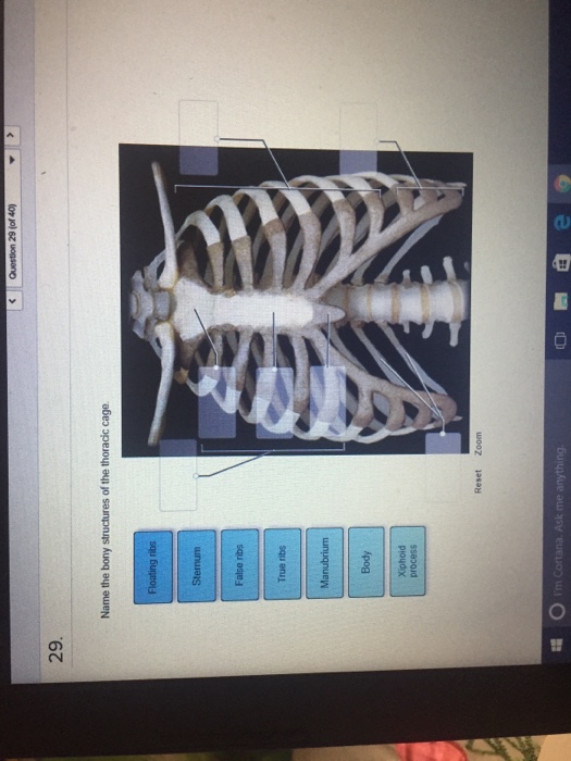 Solved 29 (or 40) 29 Name the bony structures of the | Chegg.com