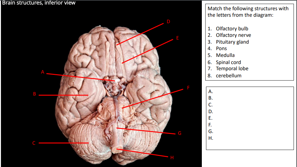 Solved D Match the following structures with the letters | Chegg.com