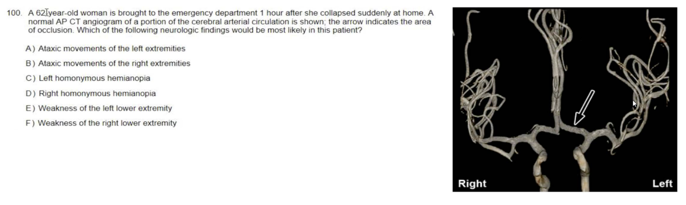 Solved A 62lyear-old woman is brought to the emergency | Chegg.com
