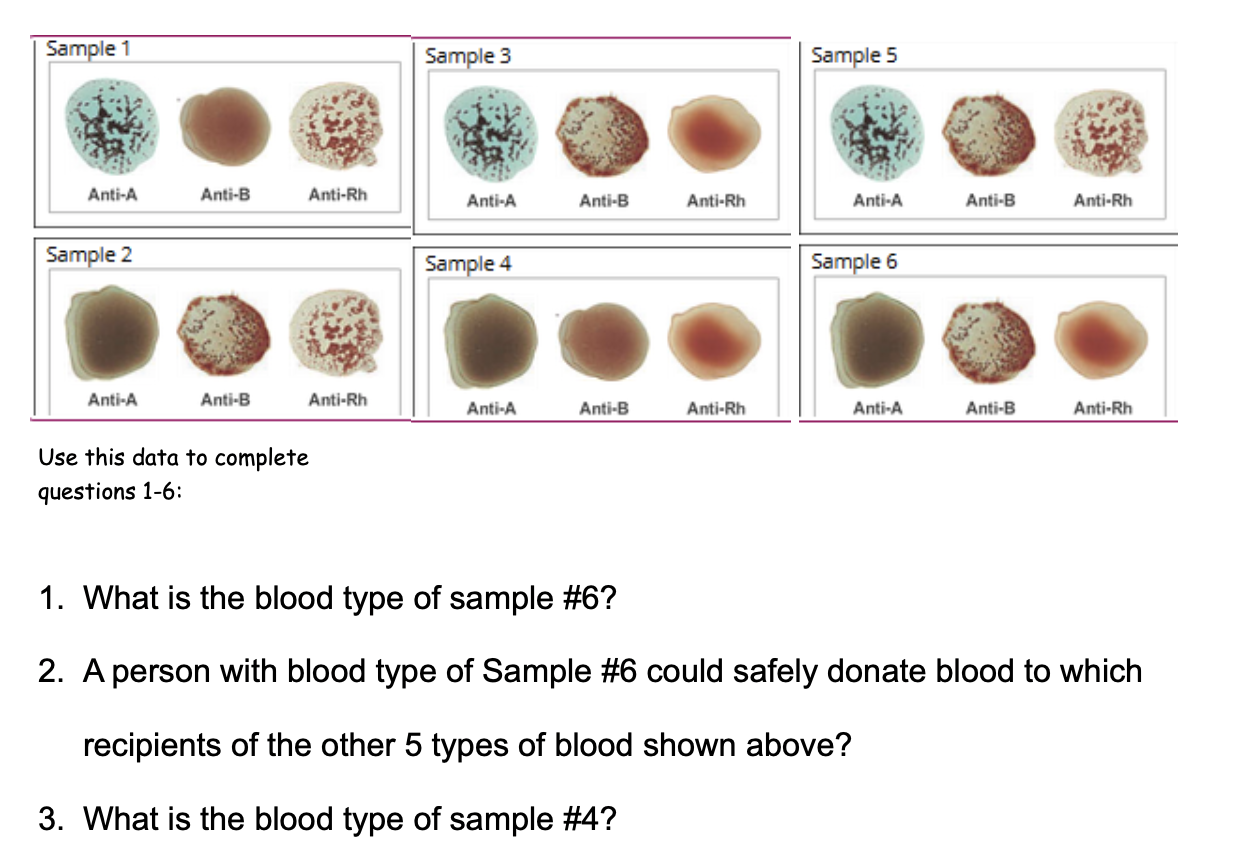 Solved Sample 1 Sample 3 Sample 5 Anti-A Anti-B Anti-Rh | Chegg.com