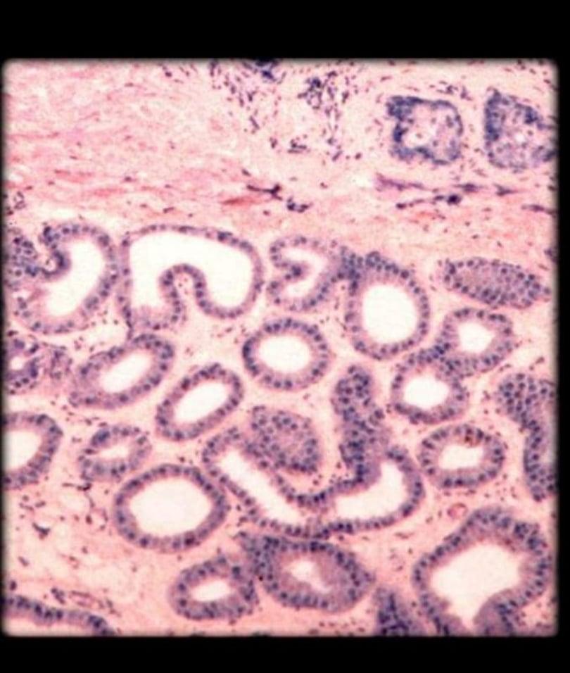 Apocrine Sweat Gland Epithelial