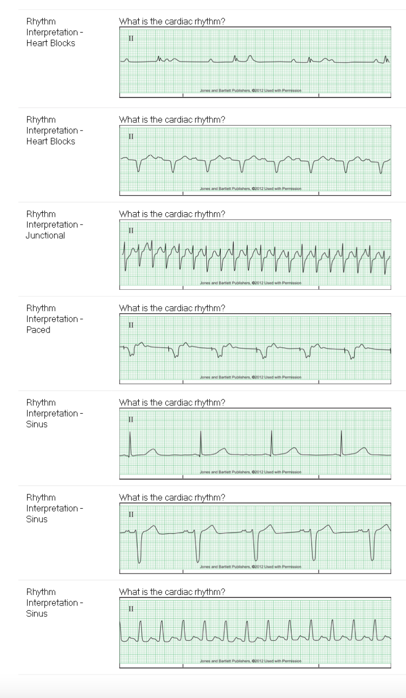 Subject Question F What is the cardiac rhythm? Rhythm | Chegg.com