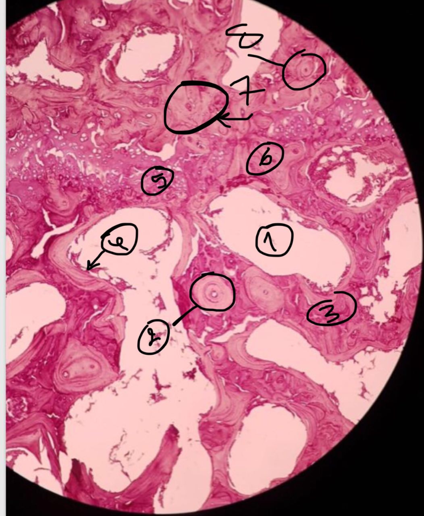 Bone Under Microscope Labeled