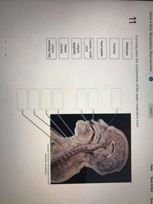 Solved: Help Correctly Label The Components Of The Upper R... | Chegg.com