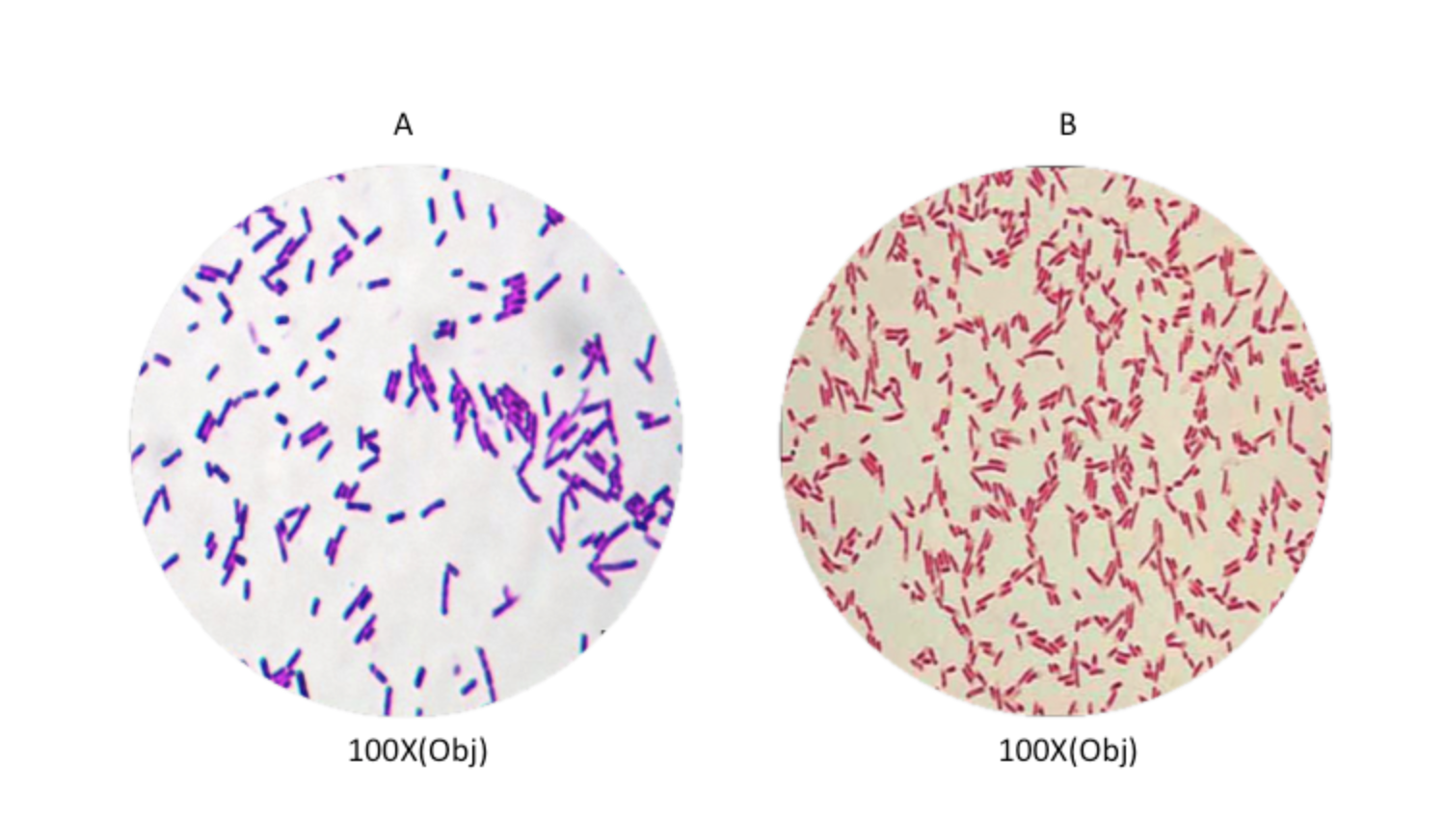 bacillus gram stain 100x