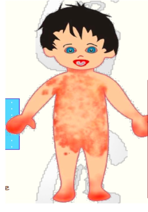 Fievre Ped Flashcards Chegg Com