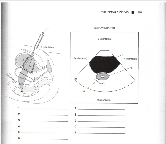 Solved THE FEMALE PELVIS 181 DISPLAY MONITOR 5 orientation 1 | Chegg.com