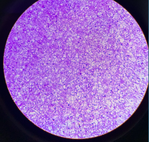 coccus bacteria 400x