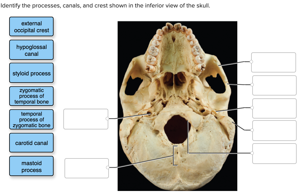 Solved Identify the processes, canals, and crest shown in