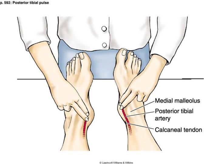 posterior tibialis pulse