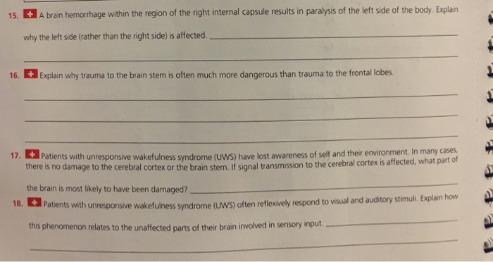 solved-15-a-brain-hemorhage-within-the-region-of-the-right-chegg