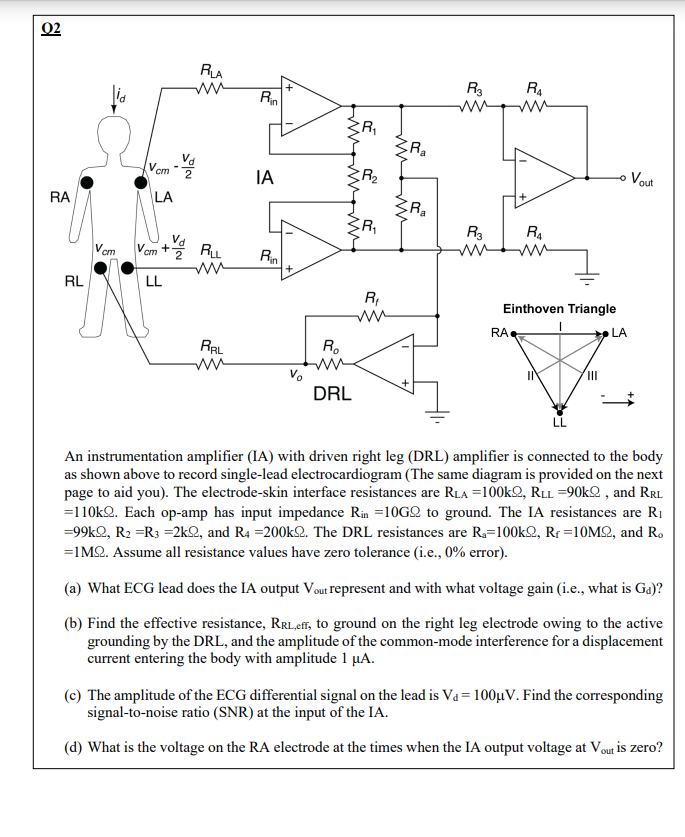 Solved An instrumentation amplifier (IA) with driven right | Chegg.com