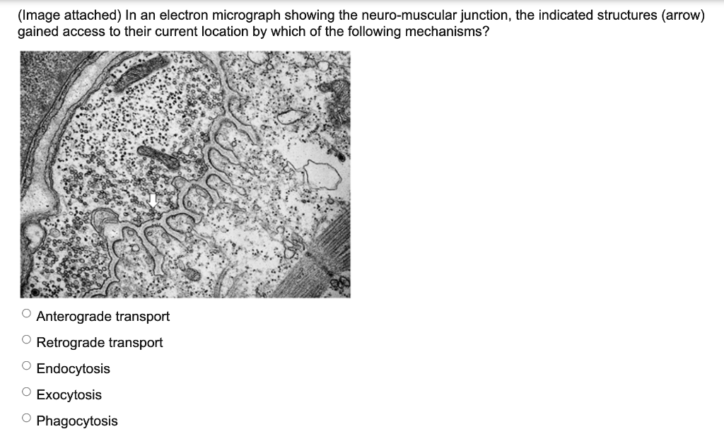 Solved (Image attached) In an electron micrograph showing | Chegg.com