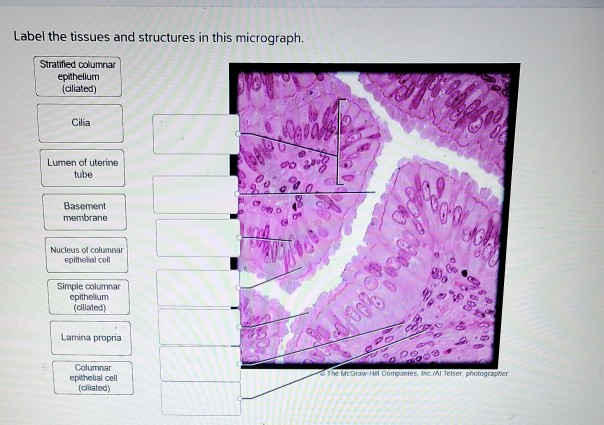 Solved: Label The Tissues And Structures On The Histology ... | Chegg.com