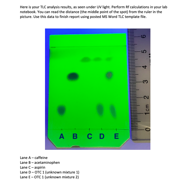 Solved Here Is Your Tlc Analysis Results As Seen Under Uv