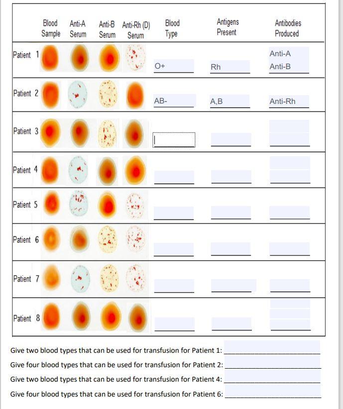 solved-blood-anti-a-anti-b-anti-rh-d-sample-serum-serum-chegg