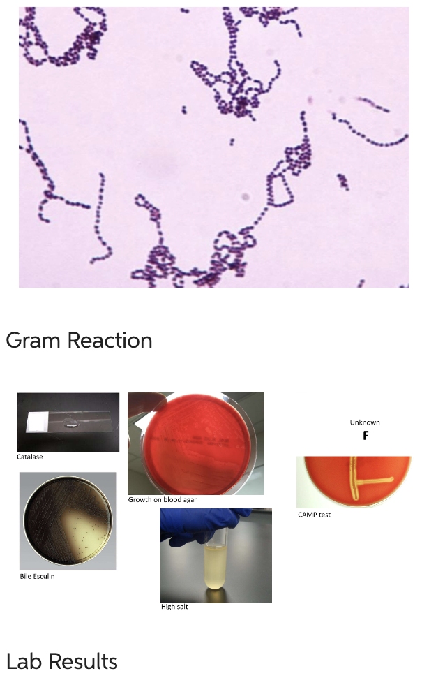 Solved Gram Reaction Lab Results | Chegg.com