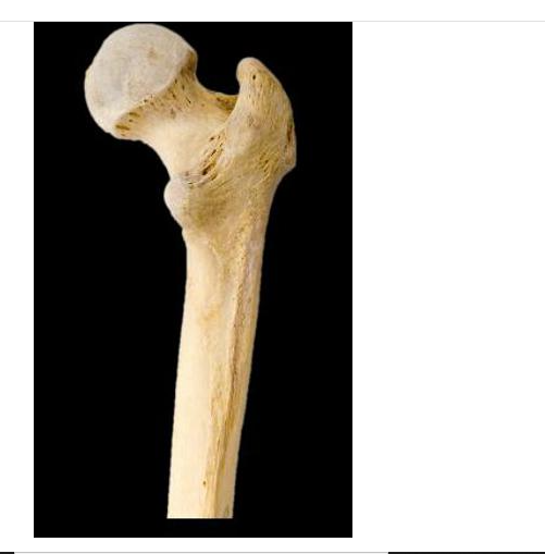 Solved Identify the bone in the image.