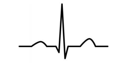 Solved a. Label each segment of the EKG wave (P, Q, R, S, | Chegg.com